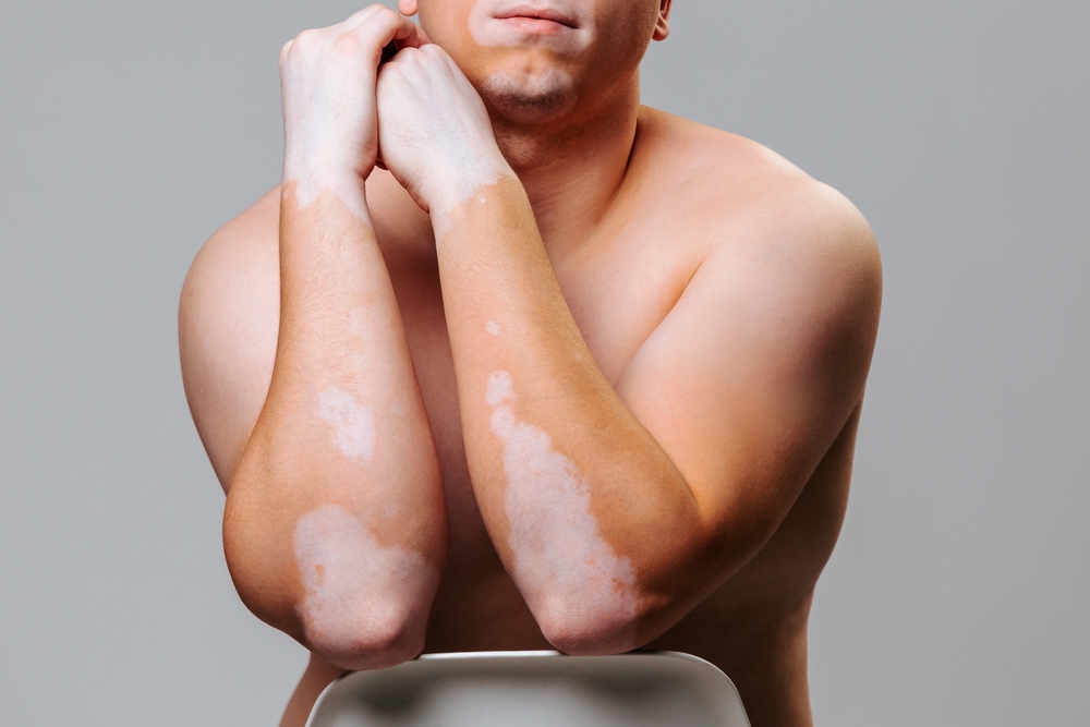 Centre des maladies rares Hero 1000x667px